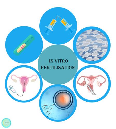 مراحل لقاح خارج رحمی IVF