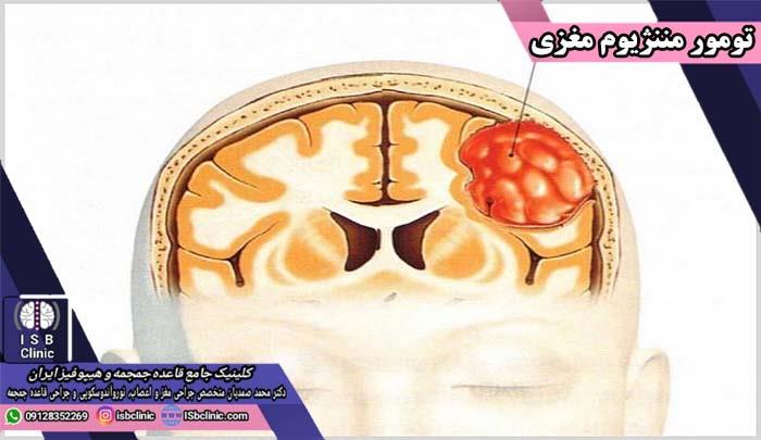 تومور مننژیوم مغزی چیست؟