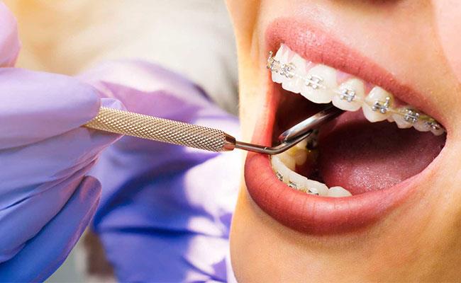 ارتودنتیست ها (مدارک دندان پزشکی و بهداشت)