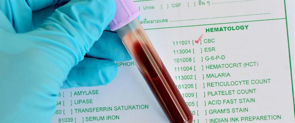 آزمایش CBC، آزمایش شمارش کامل سلول‌های خونی است