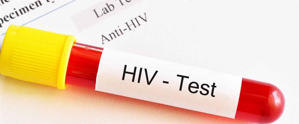 در صورت داشتن علائم ایدز حتما آزمایش HIV بدهید