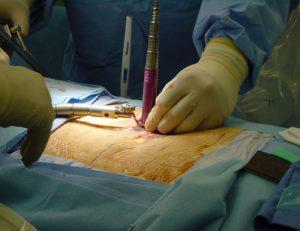 درمان قطعی دیسک کمر با روش های نوین جراحی
