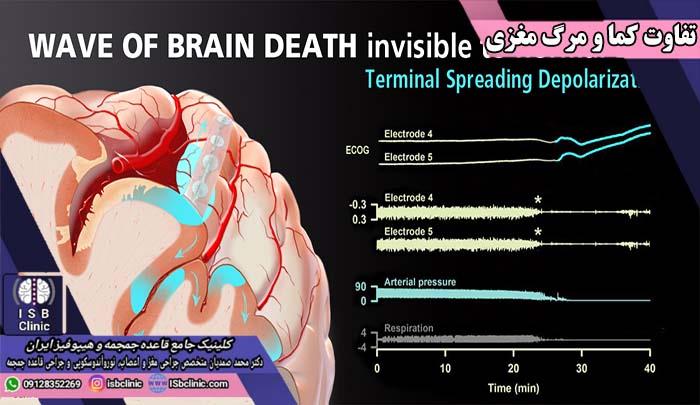 سطح هوشیاری در مرگ مغزی