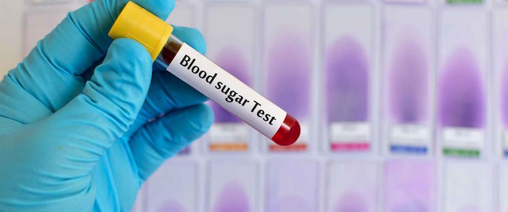 آزمایش قند خون از آزمایشهای مهمی است که به صورت منظم باید انجام داد