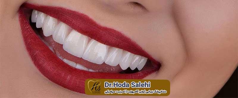 دکتر هدی صالحی دندانپزشک زیبایی در اصفهان